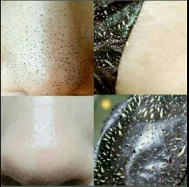 mascarilla negra facial