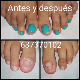 Reconstrucción uñas pies Sevilla Pedicura spa