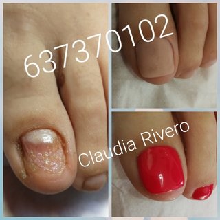Reconstrucción uñas pies Sevilla Pedicura spa