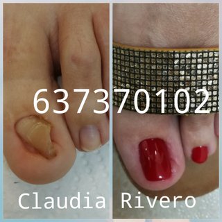 Reconstrucción uñas pies Sevilla Pedicura spa