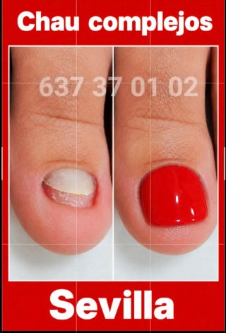 Reconstrucción uñas pies Sevilla Pedicura spa