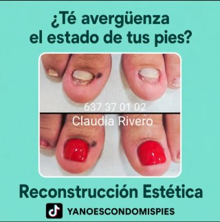 Reconstrucción uñas pies Sevilla Pedicura spa
