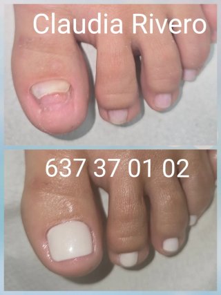Reconstrucción uñas pies Sevilla Pedicura spa