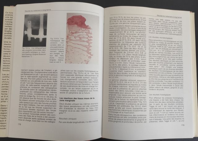 Libro Prothèses ostéo-intégrées