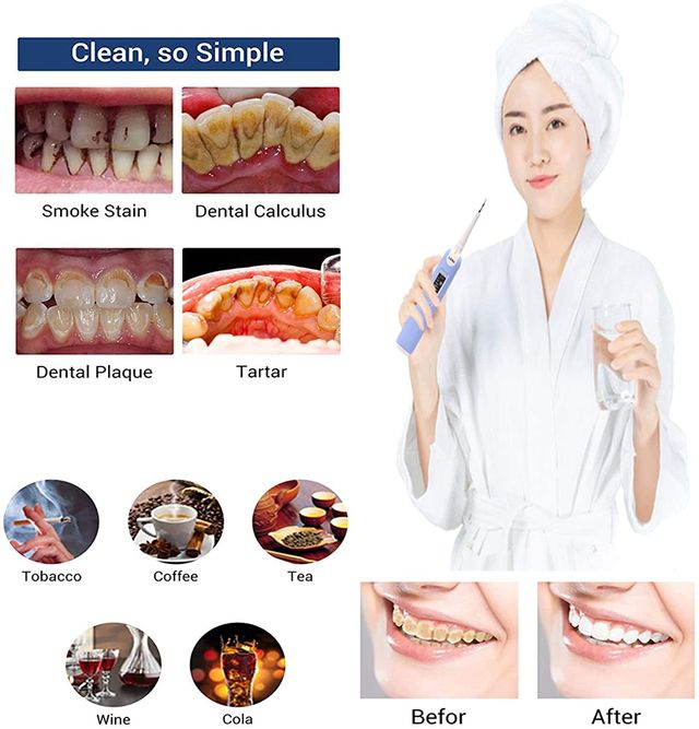 Herramientas Limpieza Dental Cepillo Electrico