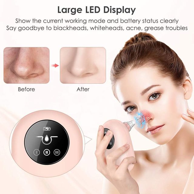 Limpiador de poros NUEVO