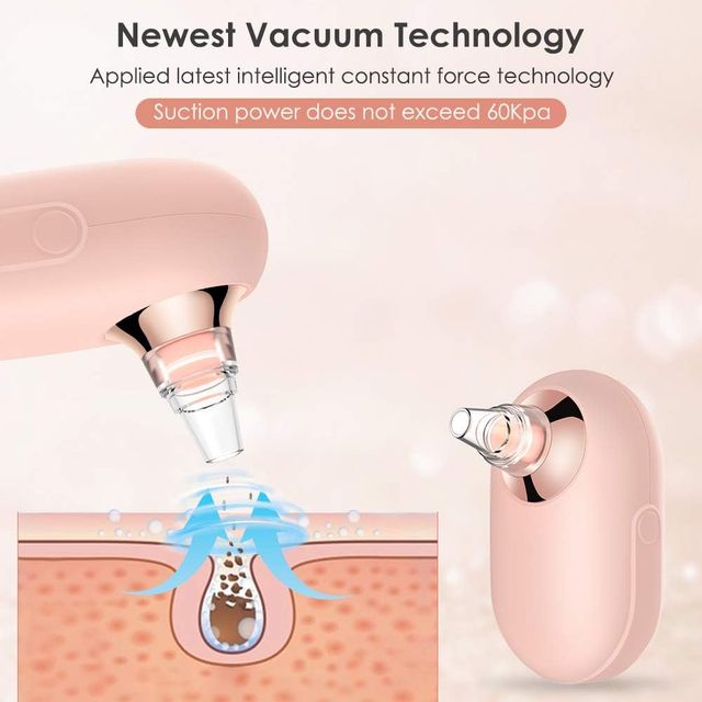 Limpiador de poros NUEVO