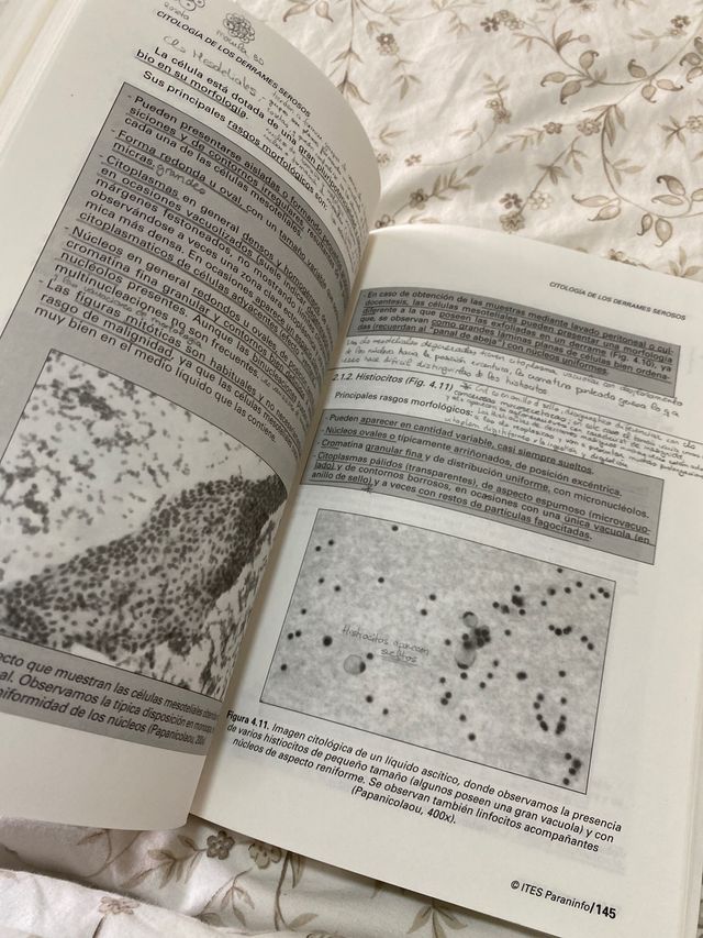 Citología de secreciones y líquidos 