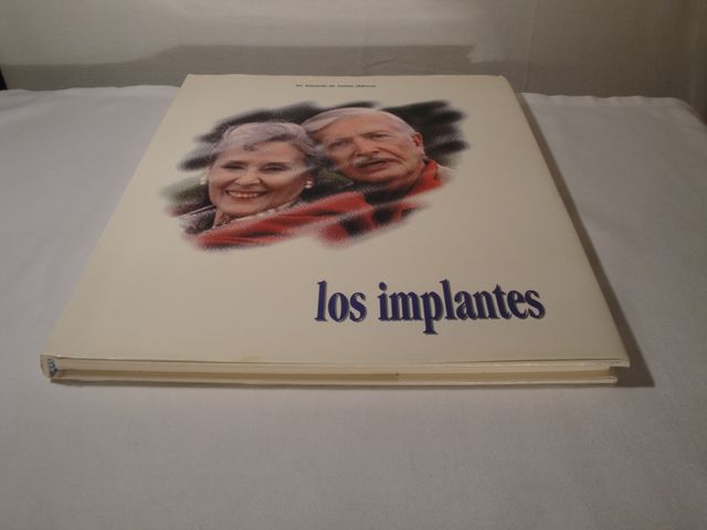 Los implantes.Dr. Eduardo Anitua Aldecoa.Año 1994