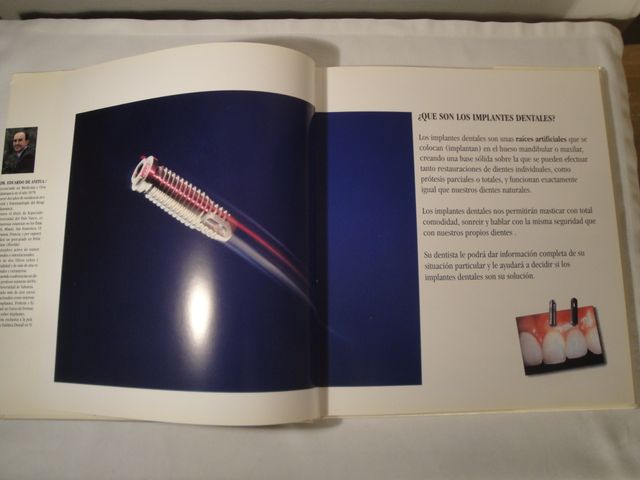 Los implantes.Dr. Eduardo Anitua Aldecoa.Año 1994