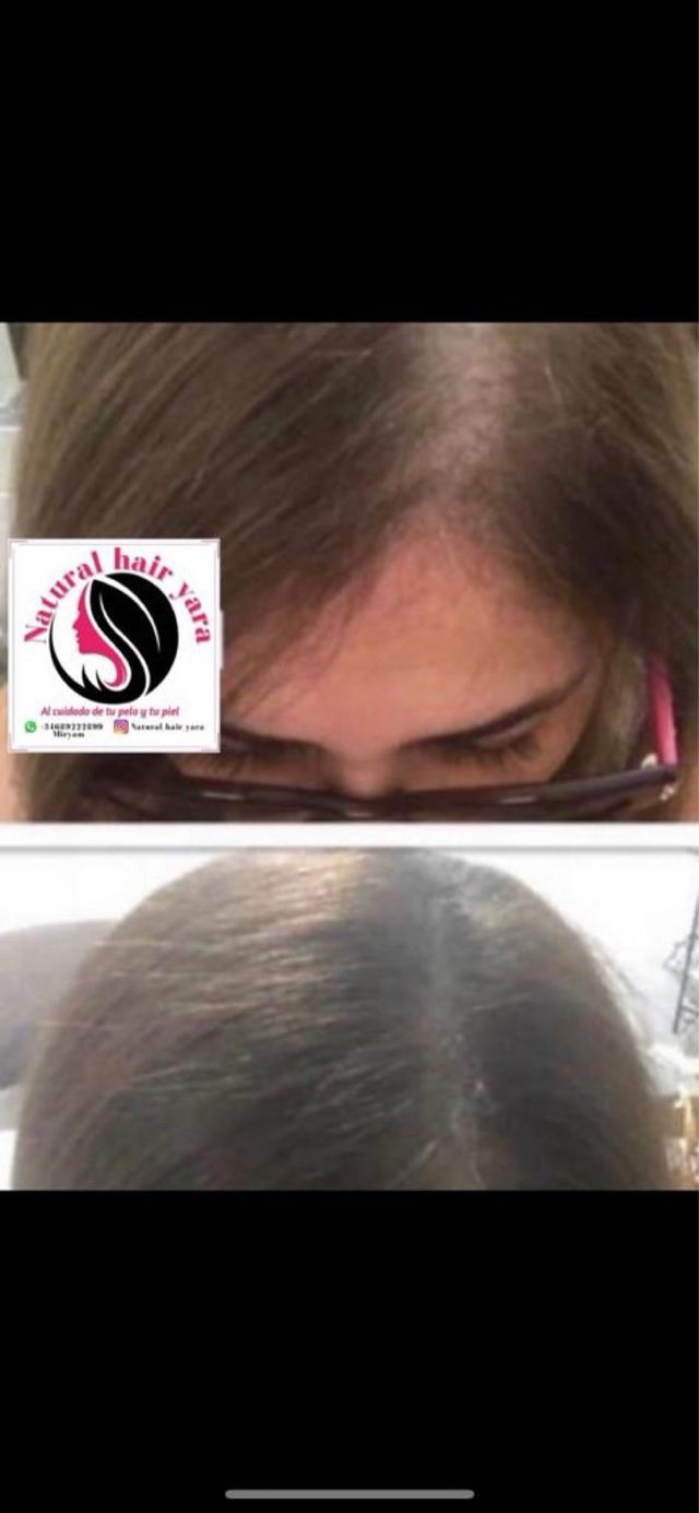 Línea capilar natural hair yara