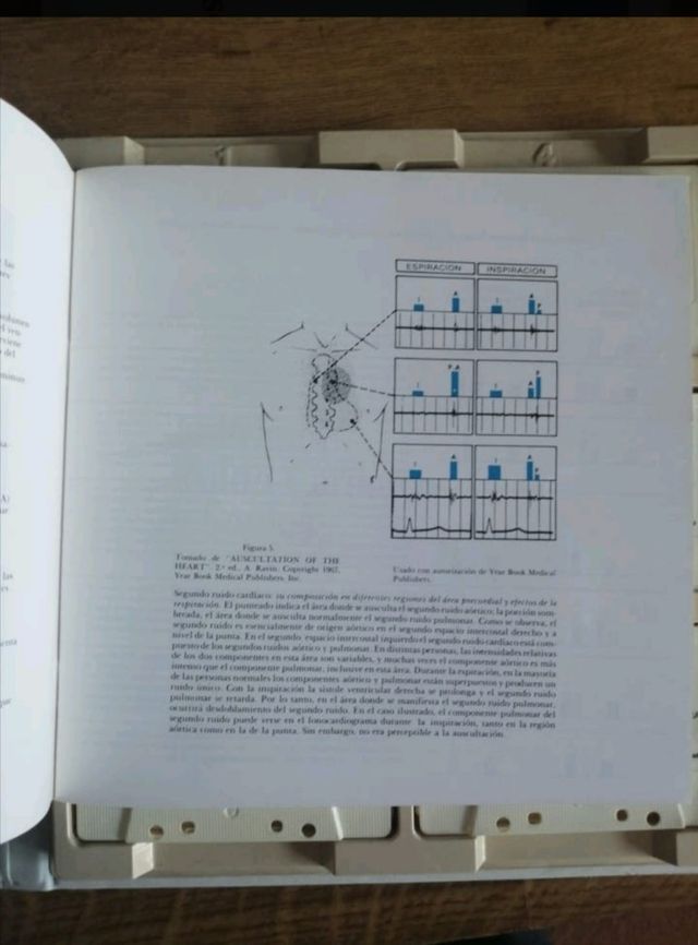 auscultación cardiaca