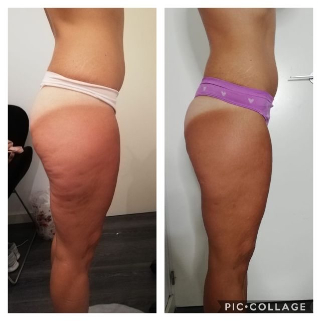 tratamientos corporales