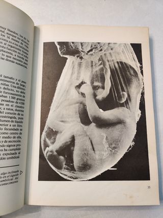 GRAN ENCICLOPEDIA FAMILIAR DE LA SALUD (1979)