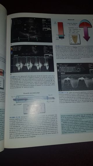 Tratado de Cardiología (Braunwald)