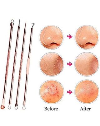 Kit 4 Piezas extractor de espinillas