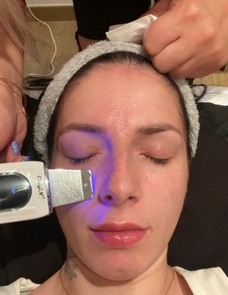 Limpieza facial personalizada combina luz led