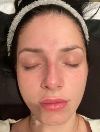 Limpieza facial personalizada combina luz led