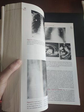 Braunwald's CARDIOLOGÍA