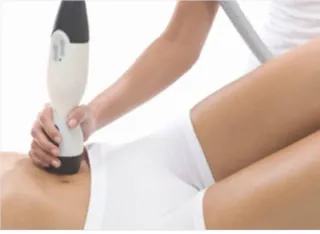 Radiofrecuencia Reaction Viora