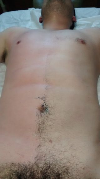 DEPILACIÓN CORPORAL A DOMICILIO