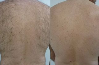 DEPILACIÓN CORPORAL A DOMICILIO