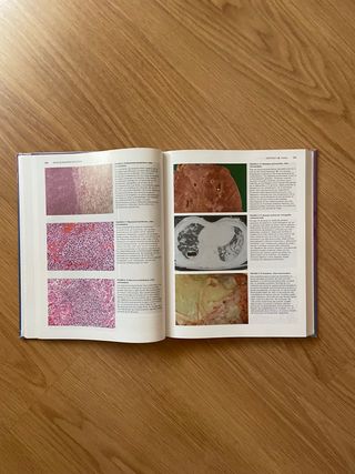 ATLAS ANATOMÍA PATOLÓGICA