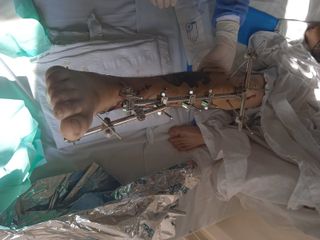 Fisioterapia y rehabilitación a domicilio