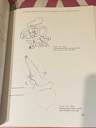 Libro de medicina Organ Preservation transplant