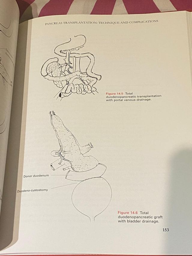 Libro de medicina Organ Preservation transplant