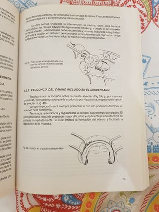 El canino incluido: diagnóstico y tratam