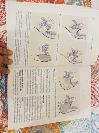 Infección odontogénica