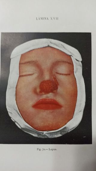 TRATADO ENF. DE LA PIEL Y VENEREAS (12)