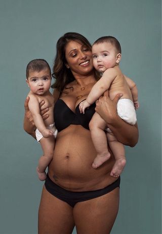 #inflamacion?retención de liquidos?dolor y estres