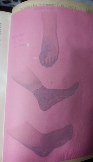 ENCICLOPEDIA DE CIRUGÍA. ASHHURST (2)