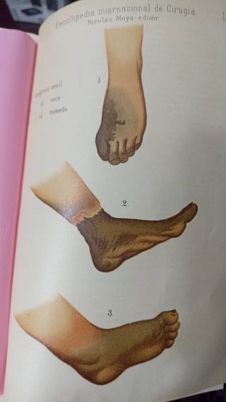 ENCICLOPEDIA DE CIRUGÍA. ASHHURST (2)