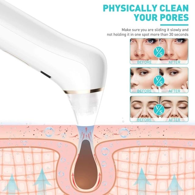 Blackhead remover vacuum