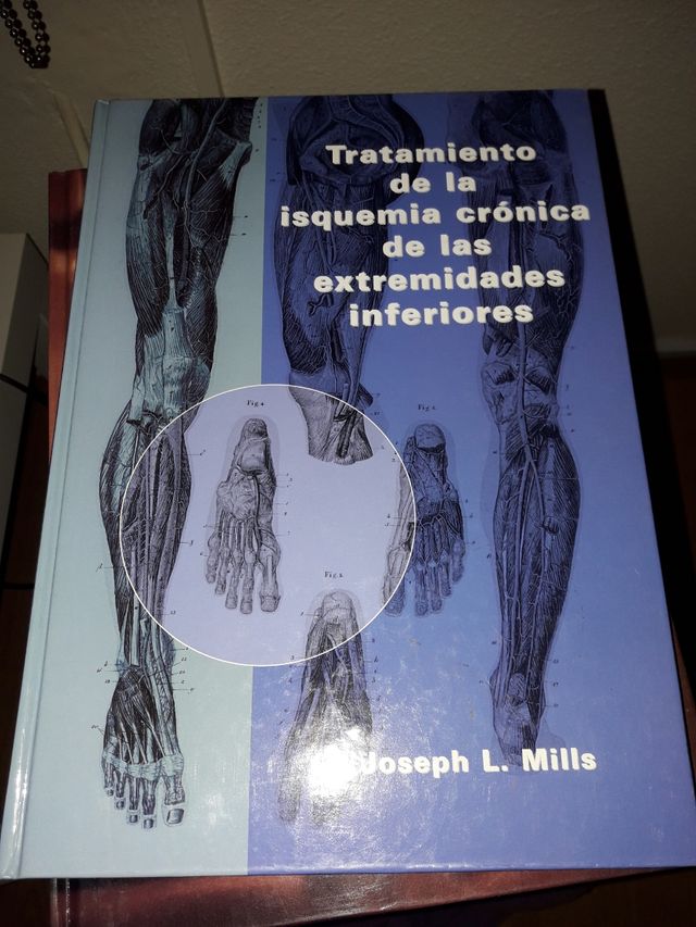 Tratamiento de la isquemia crónica