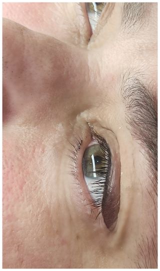 Micropigmentación facial