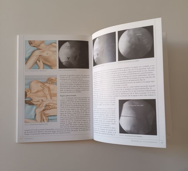 Libro - Patología Plexo Braquial