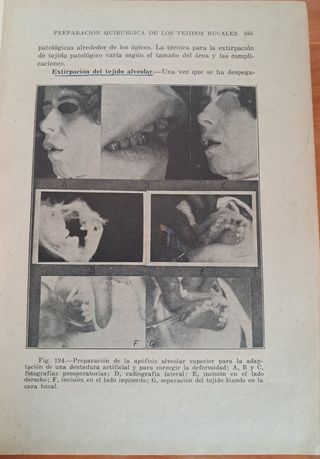 LIBRO ESTOMOLOGIA UTEHA AÑO 1939 CIRUGÍA BUCAL