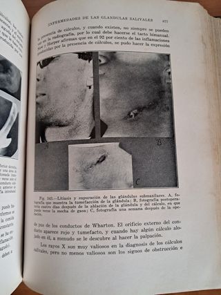 LIBRO ESTOMOLOGIA UTEHA AÑO 1939 CIRUGÍA BUCAL