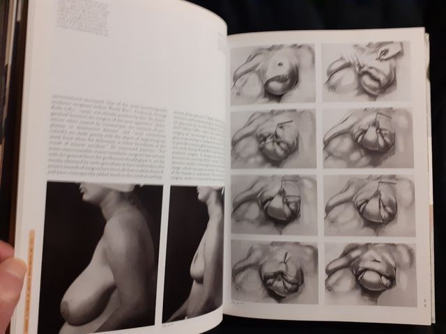 Taschen, Aesthetic Surgery 