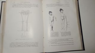 La ortopedia indispensable a los medicos