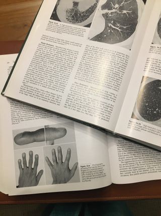 Murray. Texbook of Respiratory Medicine. 3 edition