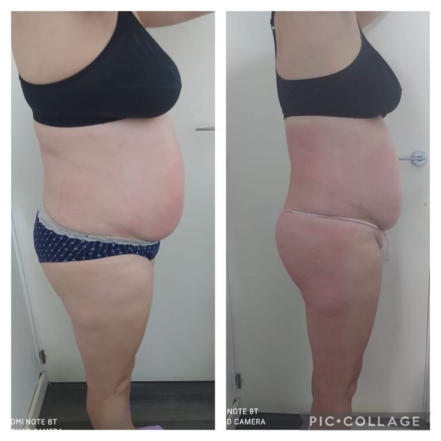 tratamienro reductor