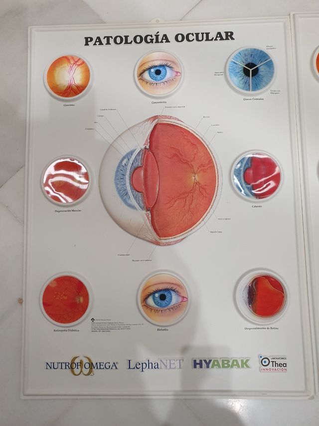 Cuatro láminas de oftalmología plástico