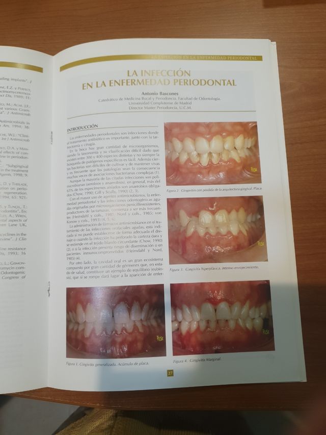 Infecciones y dolor en Odontoestomatolog