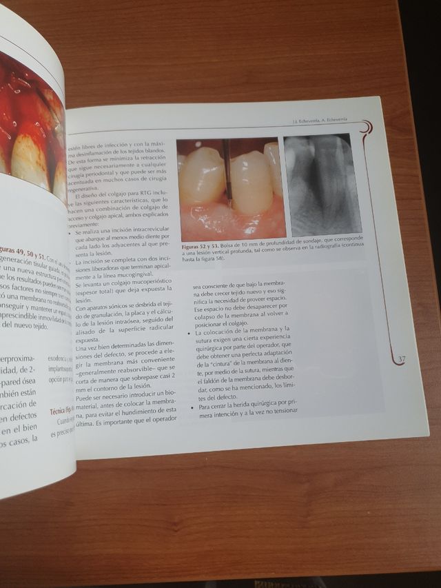 Manual de Cirugía periodontal