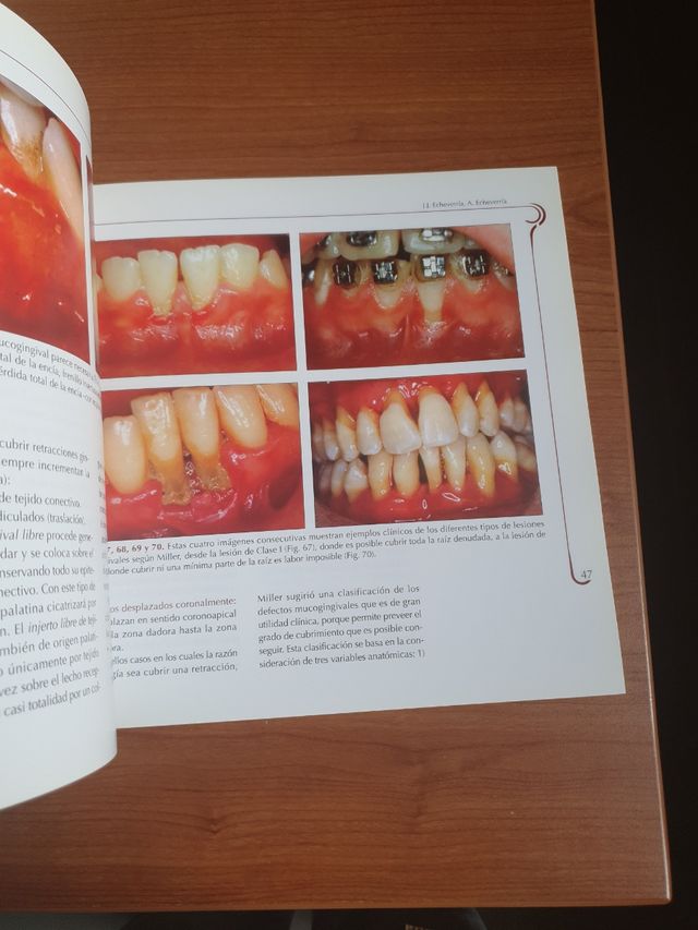 Manual de Cirugía periodontal